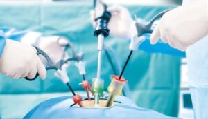 General & Laparoscopic Surgery